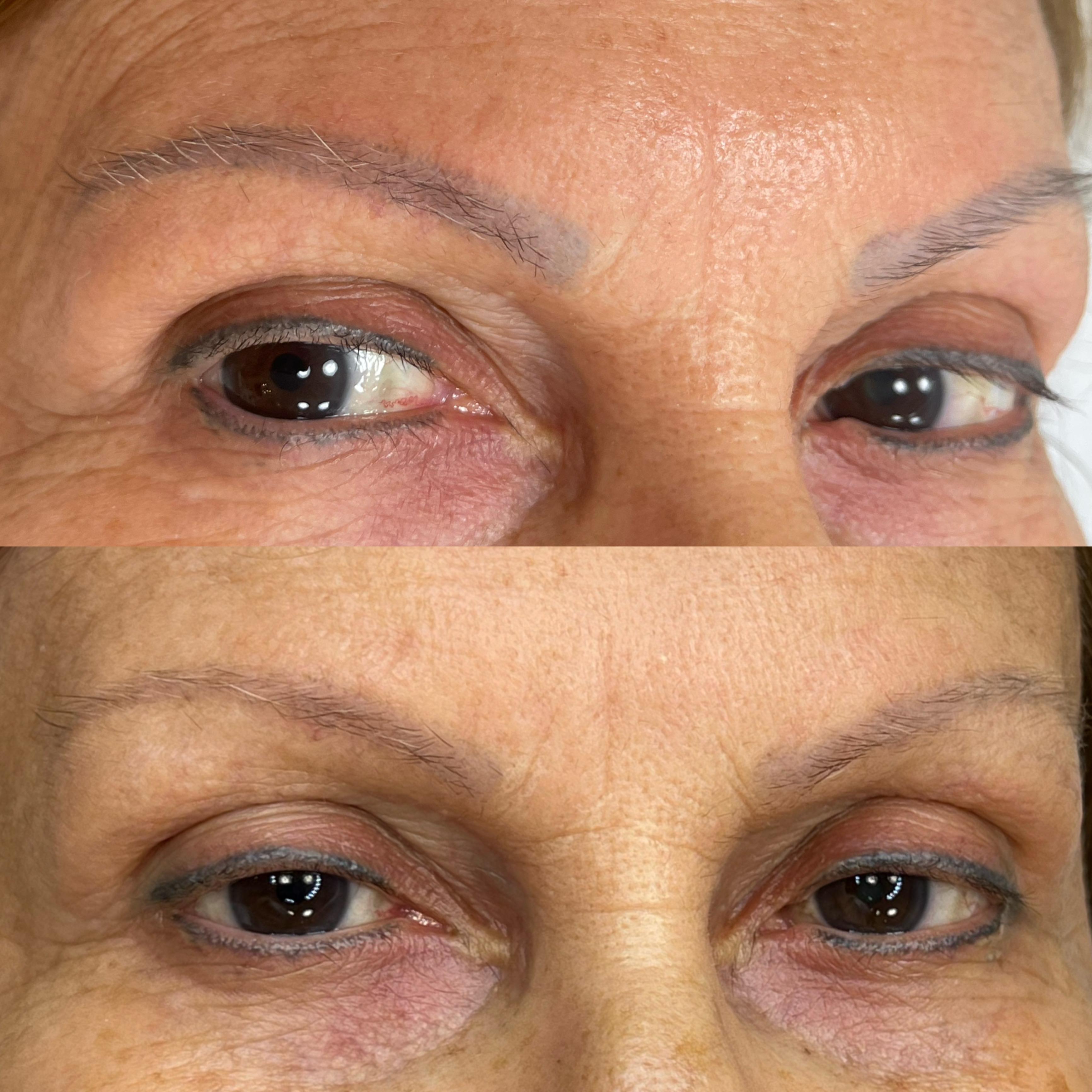Antes e depois — caso 03