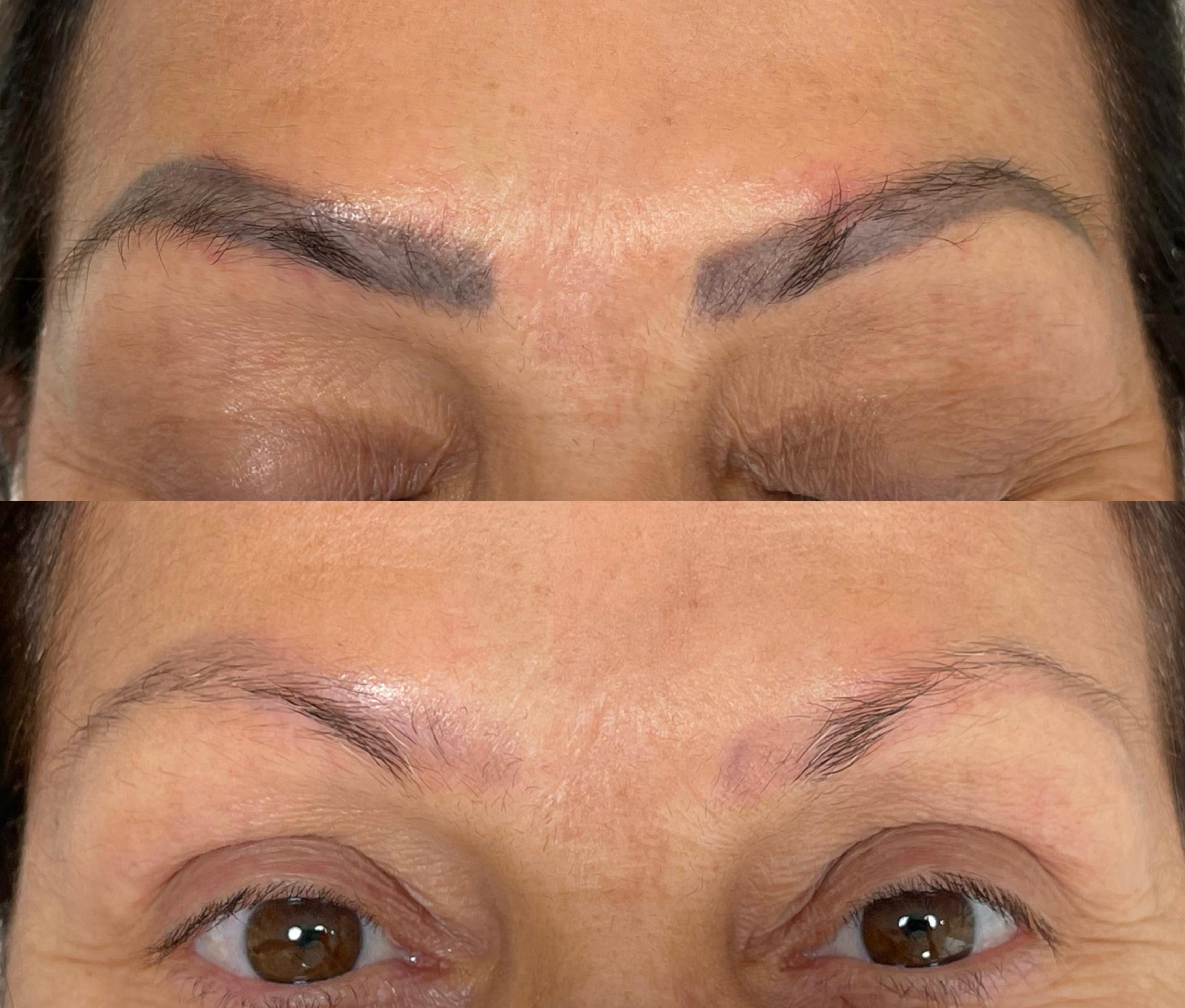 Antes e depois — caso 04