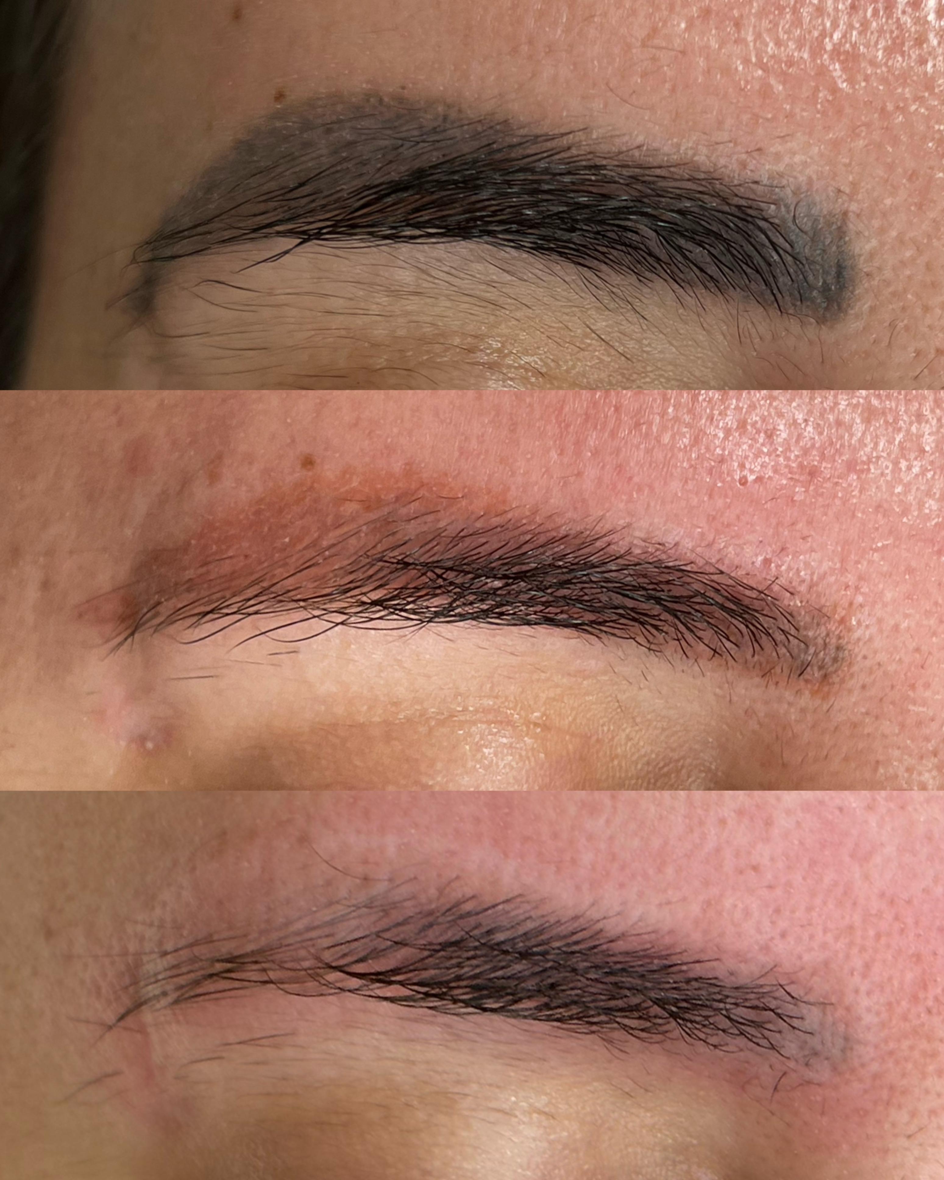 Antes e depois — caso 05
