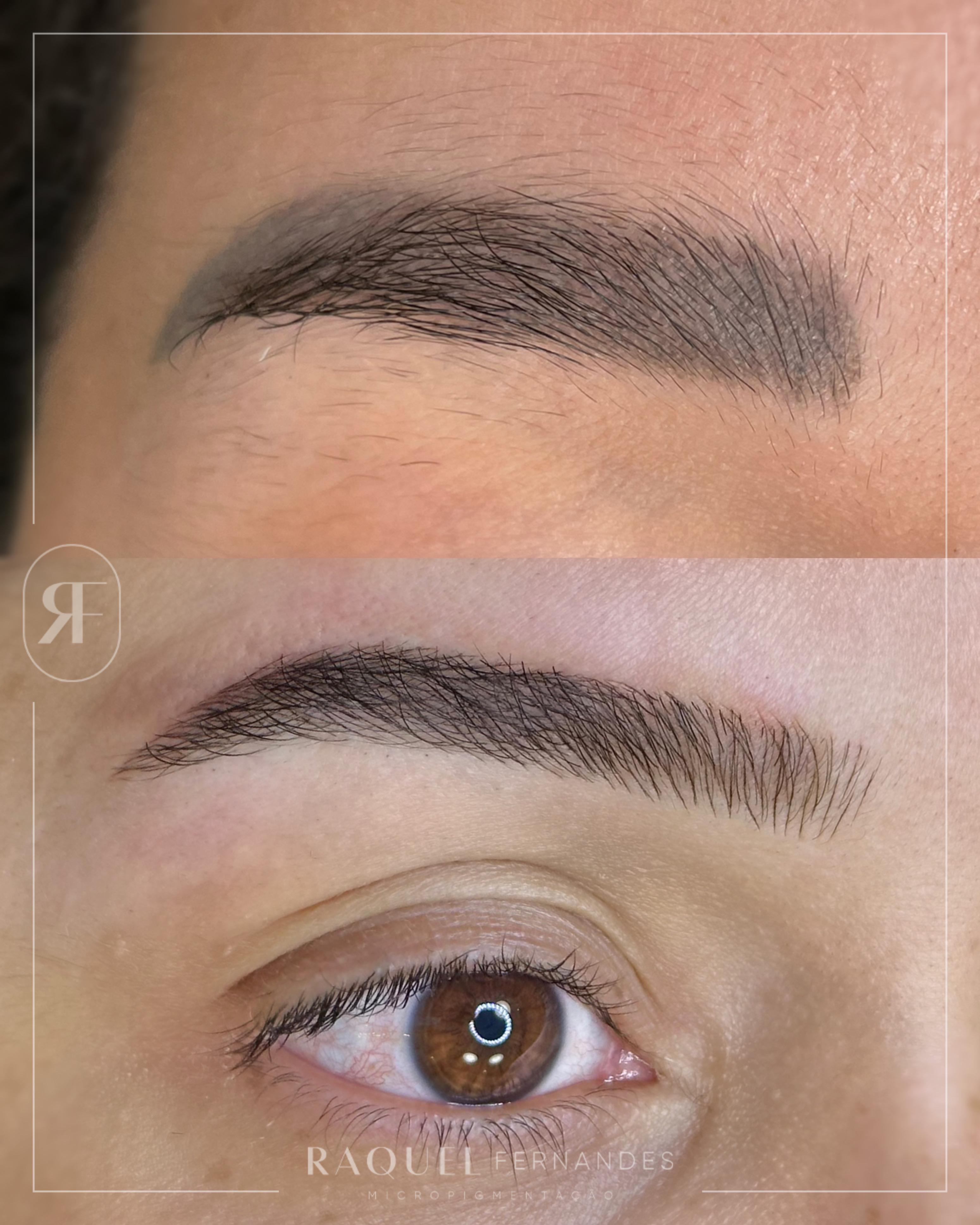 Antes e depois — caso 06