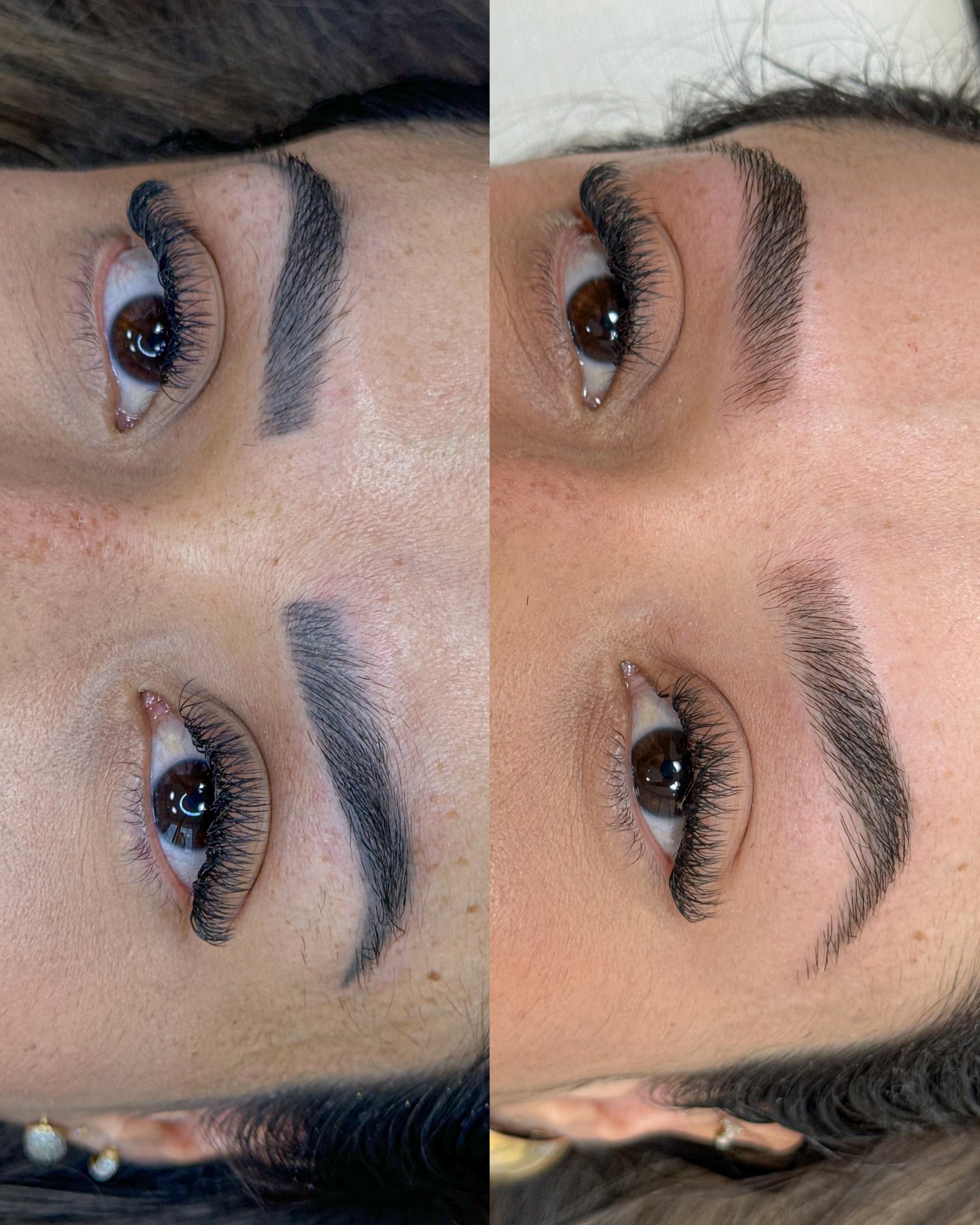 Antes e depois — caso 07