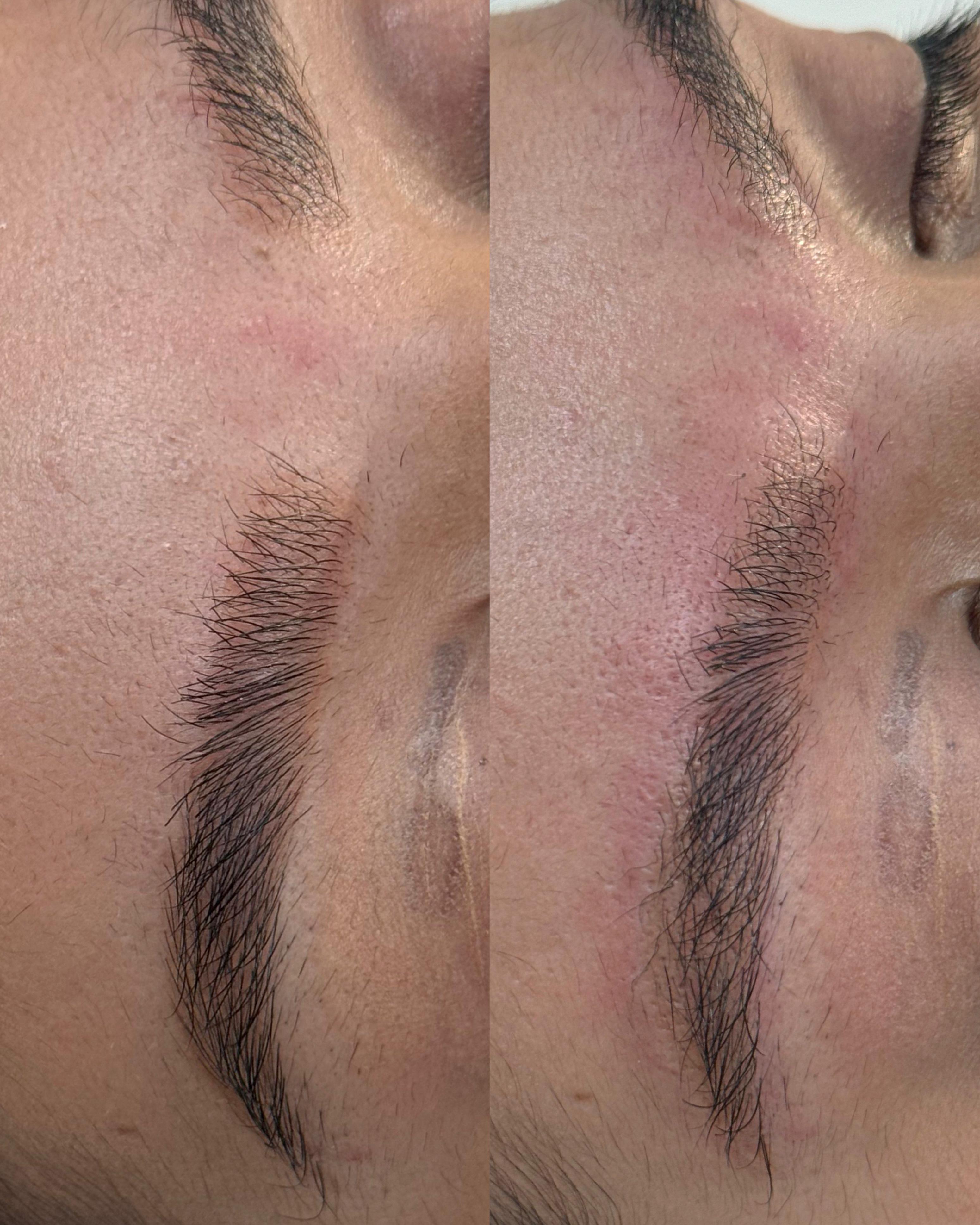 Antes e depois — caso 08