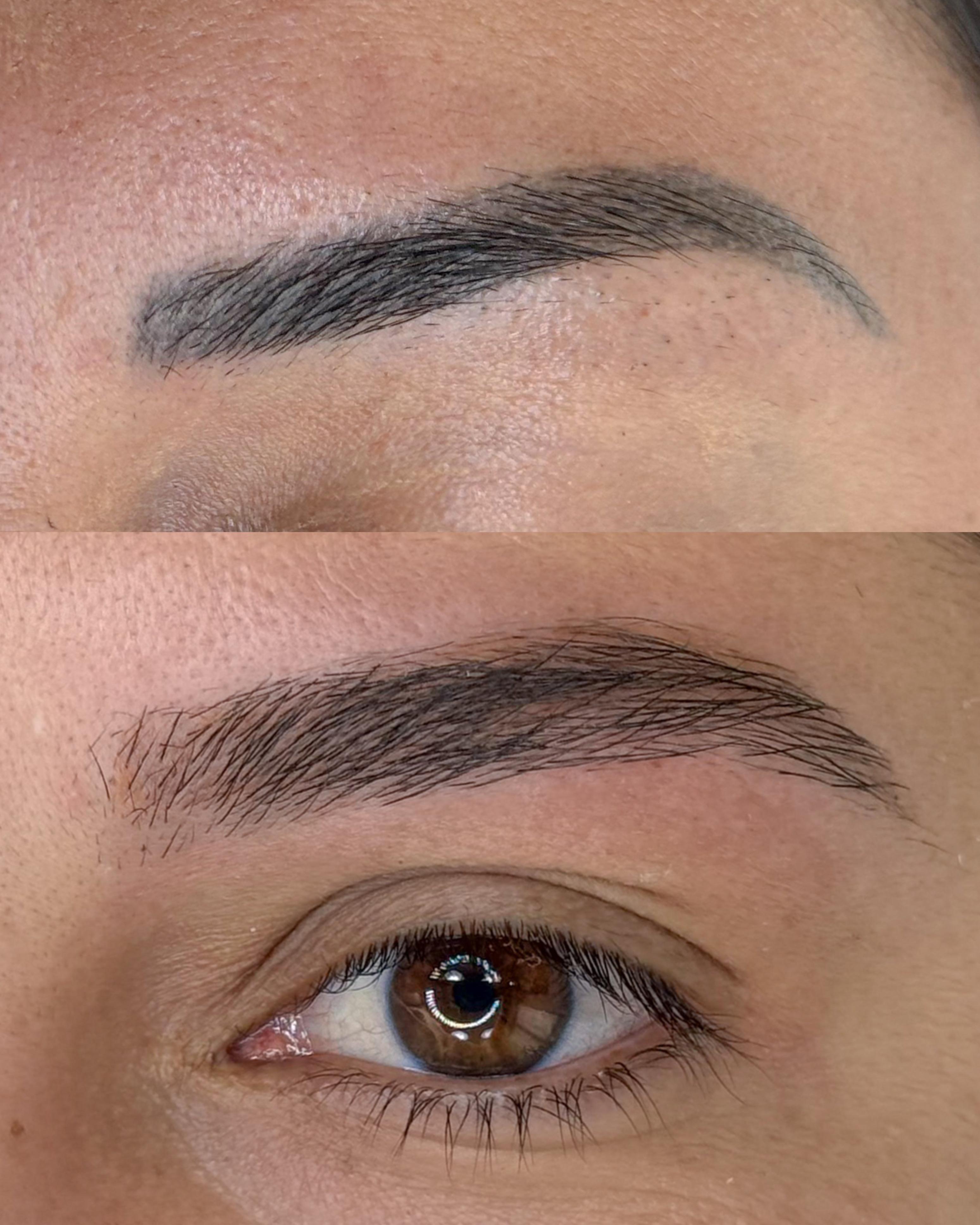 Antes e depois — caso 09