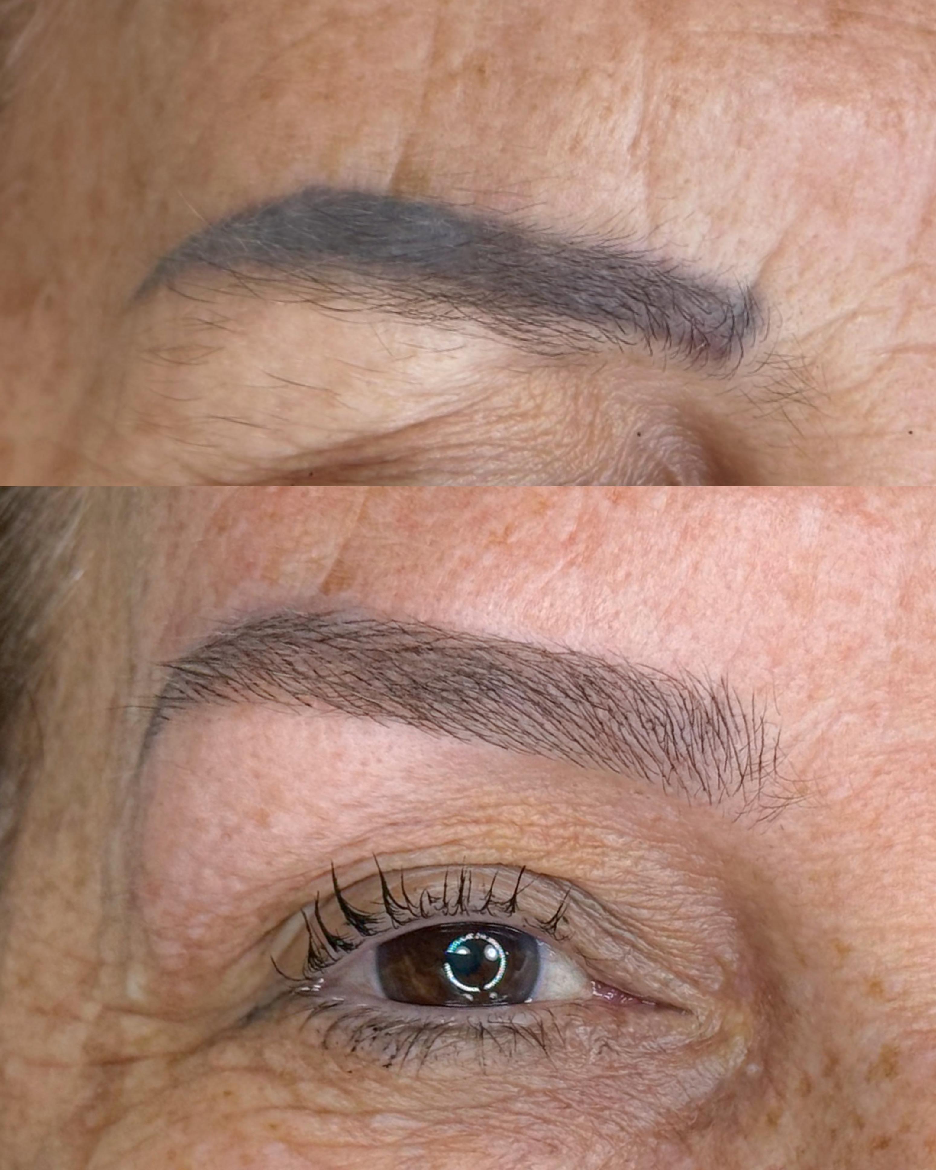Antes e depois — caso 10
