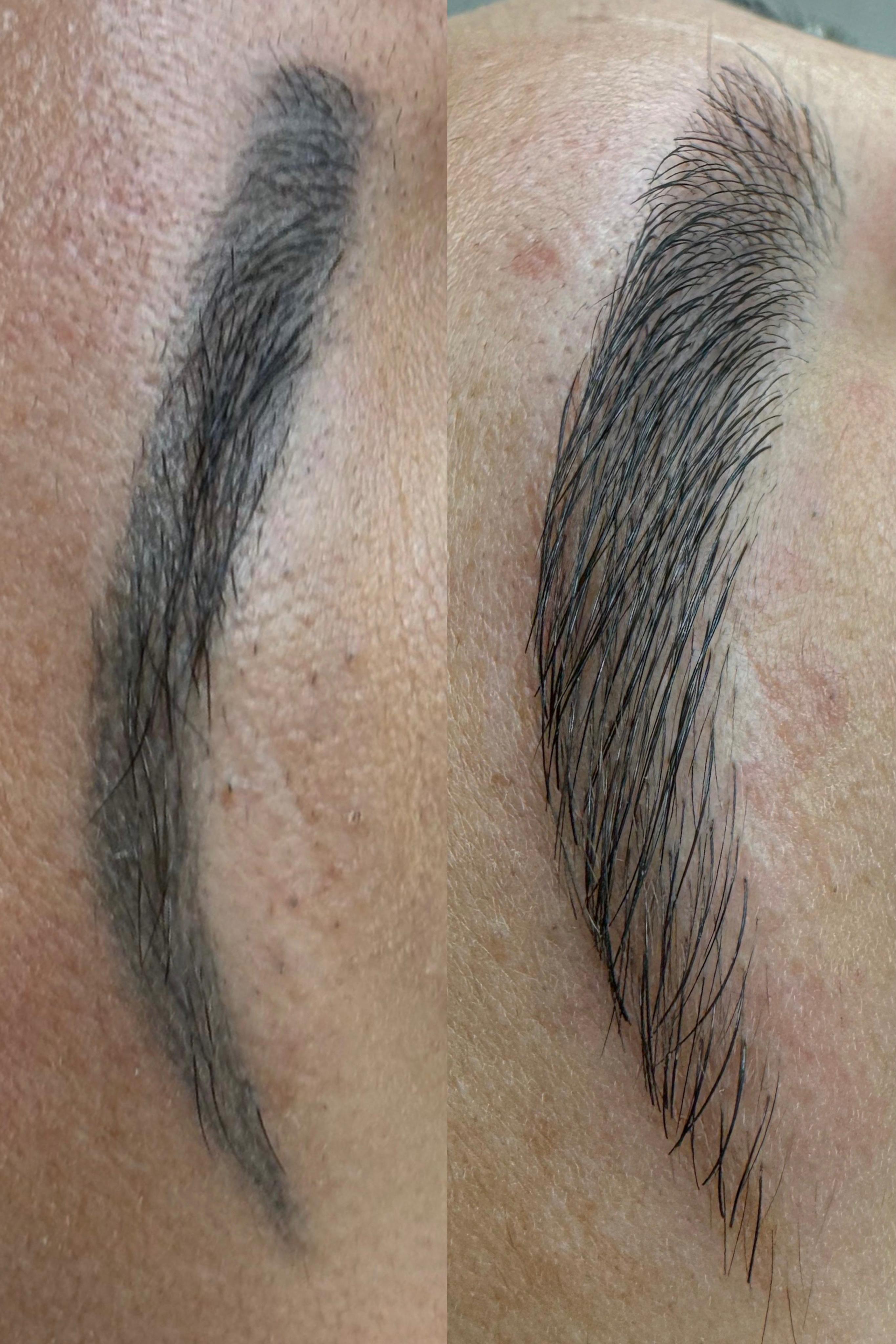 Antes e depois — caso 11