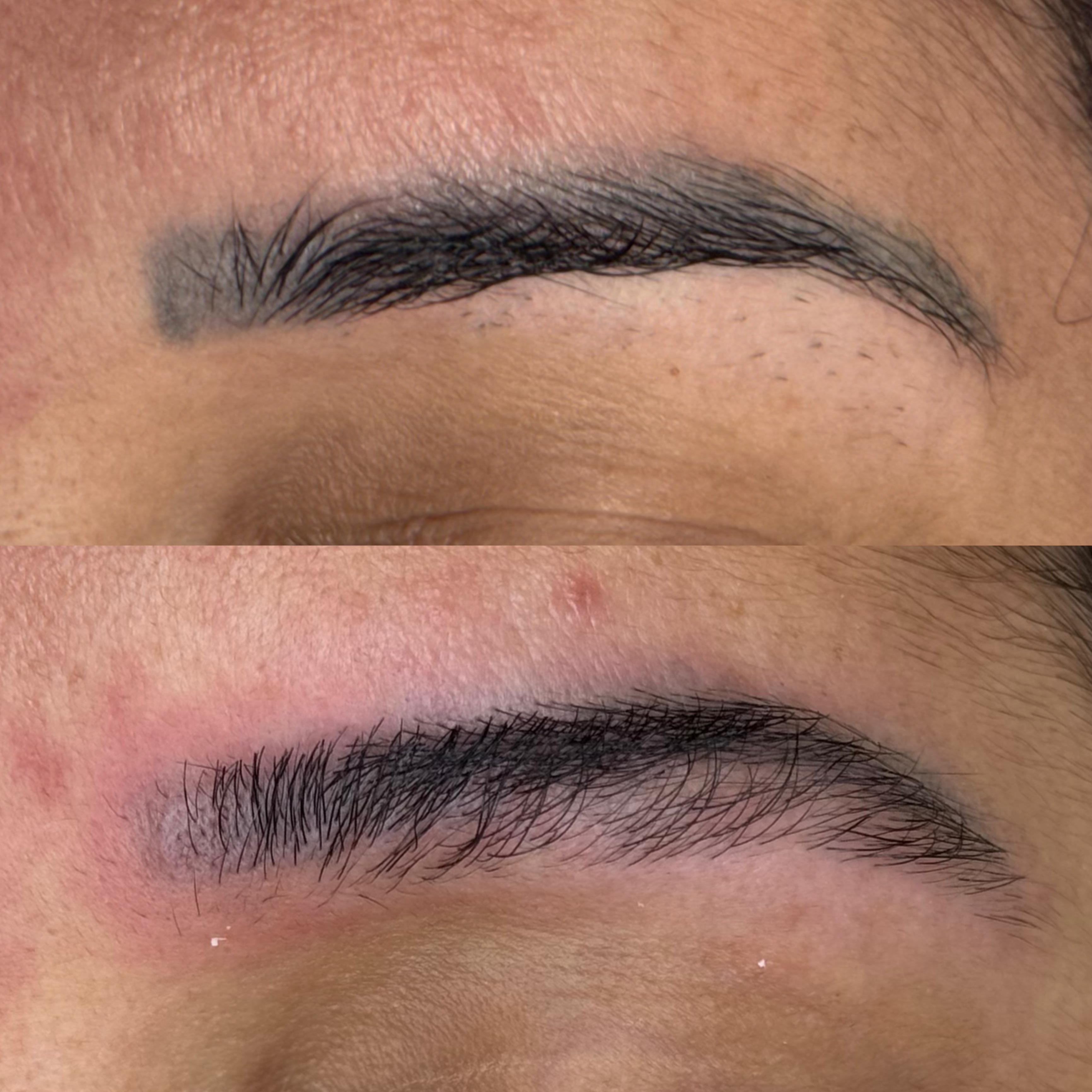 Antes e depois — caso 12